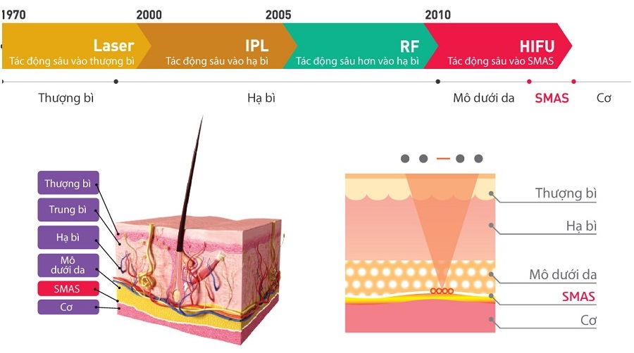 máy nâng cơ mặt hifu