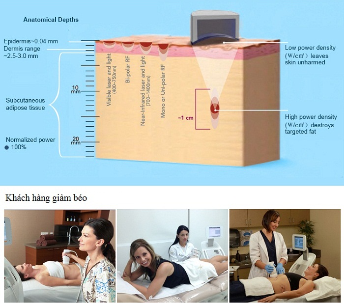 máy giảm béo liposolix-2