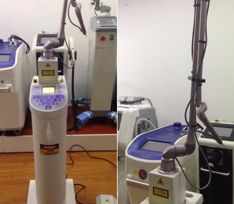 máy laser co2