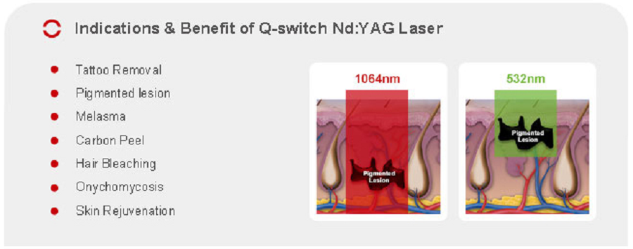 <b><i><a class='text-danger' title='máy laser trị nám curas' href=http://aaubeauty.com/thiet-bi-tham-my-47/>máy laser trị nám curas</a></i></b> -6