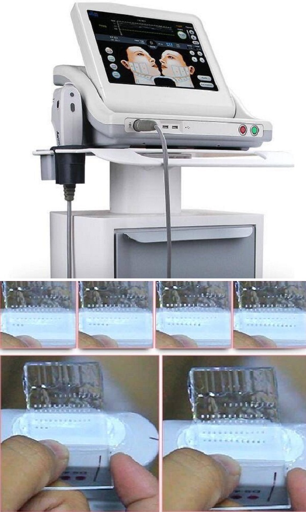 <b><i><a class='text-danger' title='máy nâng' href=http://aaubeauty.com/thiet-bi-tham-my-47/>máy nâng</a></i></b> cơ hifu ultherapy