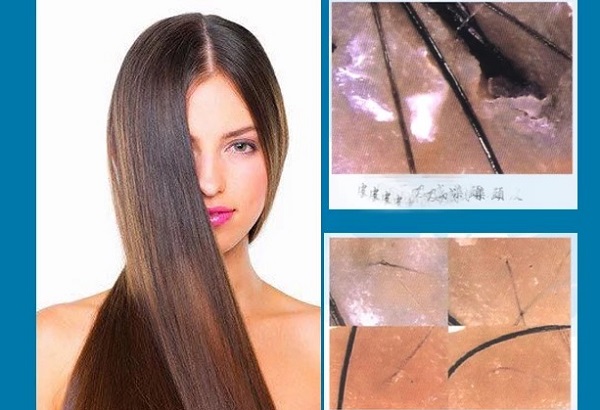 máy soi da kết nối máy tính -2