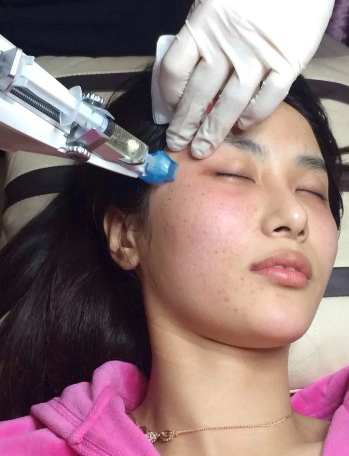 máy tiêm dưỡng chất