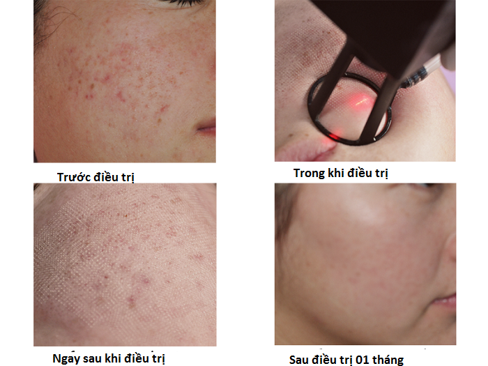 hình ảnh điều trị