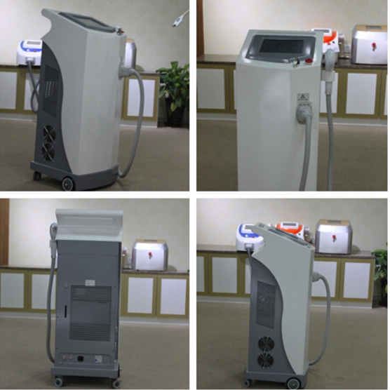 Máy triệt lông: 808nm Diode laser