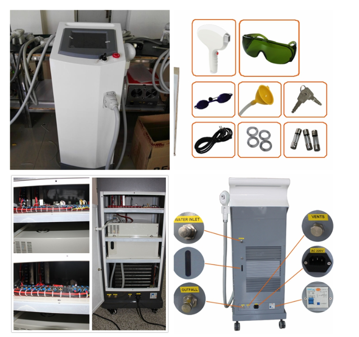 Máy triệt lông: 808nm Diode laser