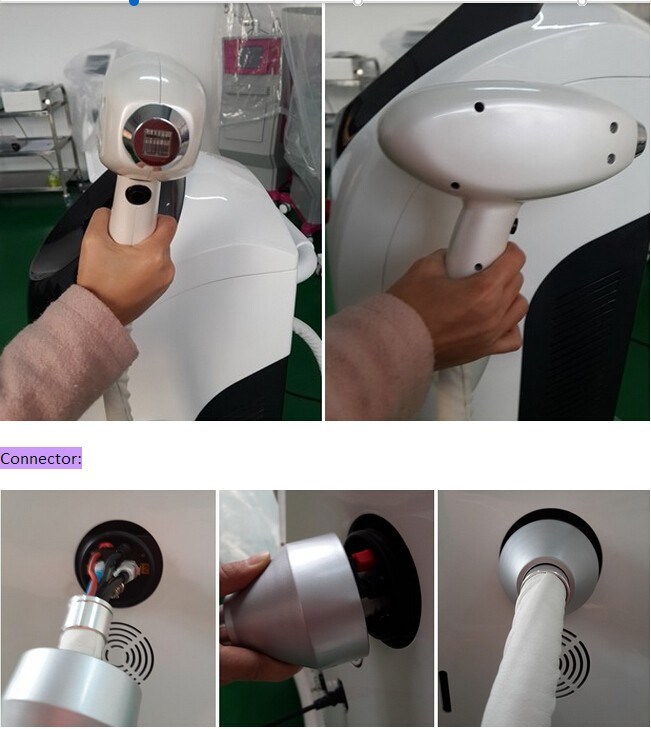 máy triệt lông mini diode laser