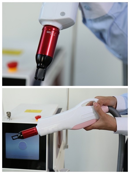 máy laser xóa xăm